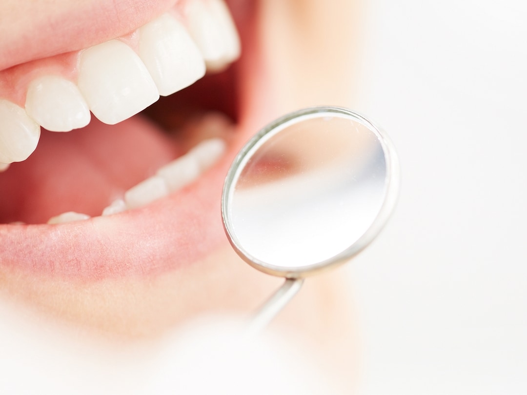 Tooth Extraction Procedures Richard A. Urbanek Jr. DDS, MS, PA Wichita Falls, TX